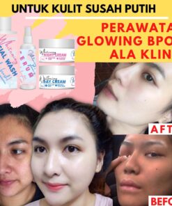 Distributor/Suplier/Penyedia/Agen/Jual SKINCARE SUSAH PUTIH-Perawatan Wajah Glowing Ala Korea-Cream Glowing Jerawat Flek Kusam by WAZATARU [WA 085730453518]